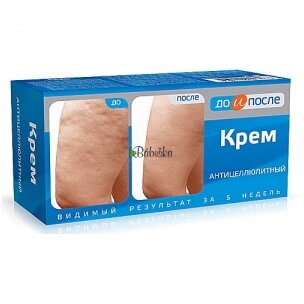 Pred a po krém na celulitídu 100 ml. 